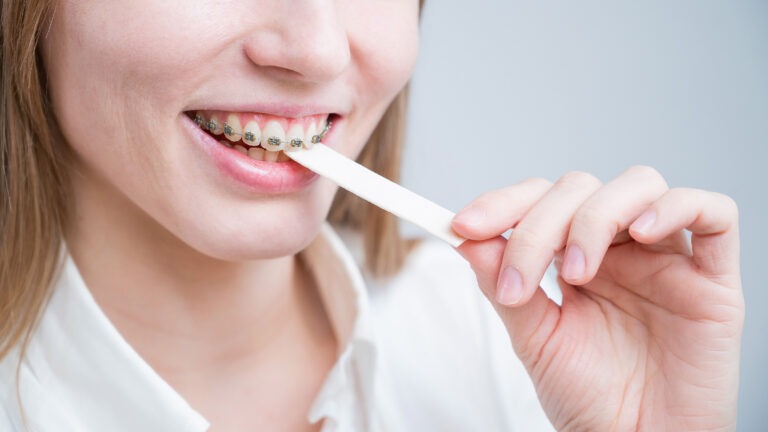 Serene Can U Chew Gum With Braces Picture Digital Art Serene Can U Chew Gum With Braces Picture Digital Art